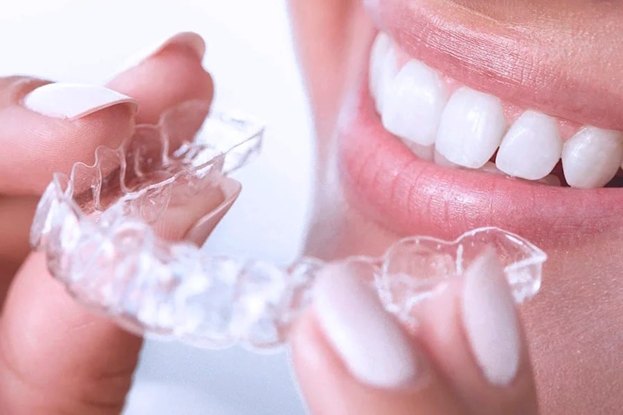 Aligners